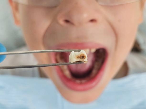 Best Emergency Treatment for Jaw Pain or Injury in Pardeeville, WI